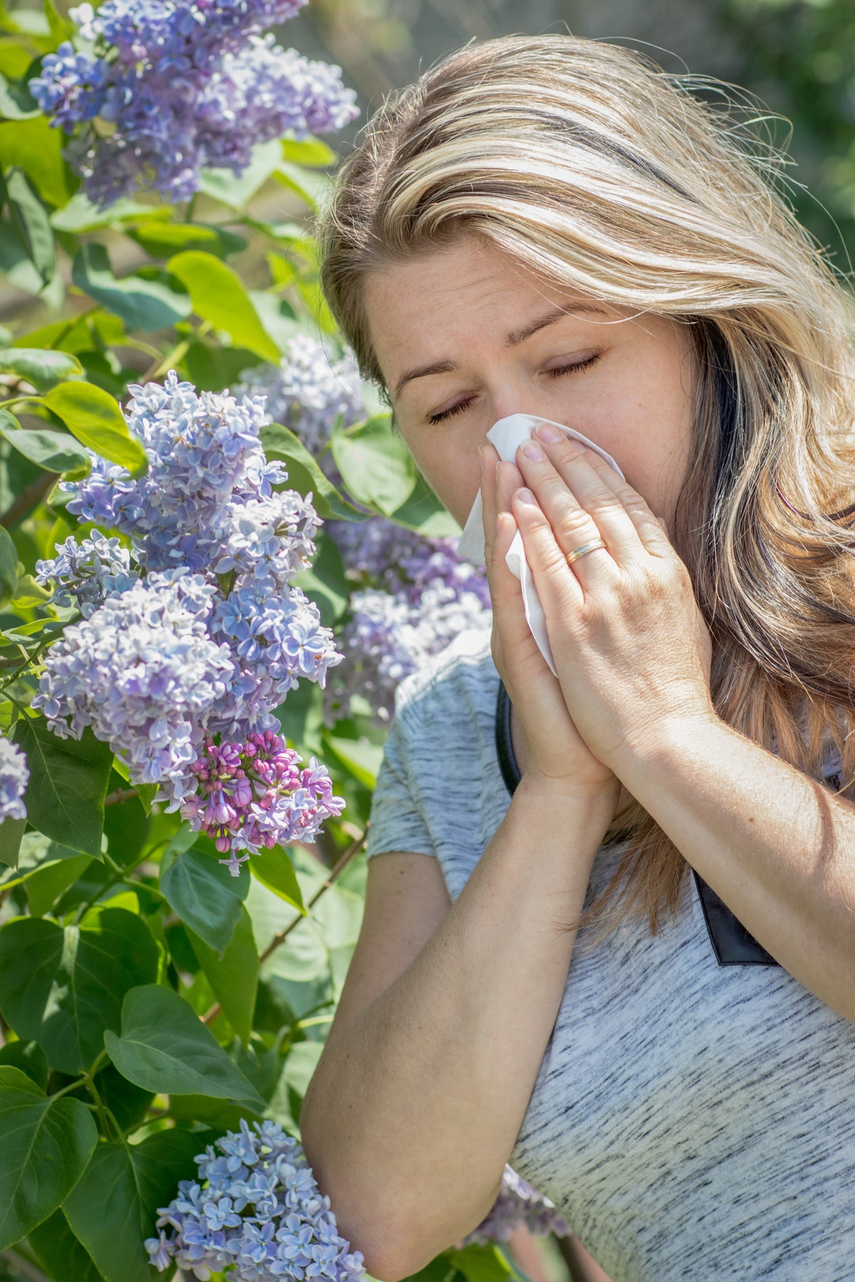 healthy embraces image allergic