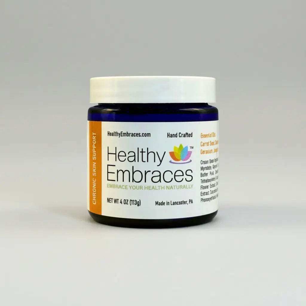 Healthy Embraces Chronic Skin Support Cream in a 4oz jar, showing the creamy texture and label for long-term skin condition relief.