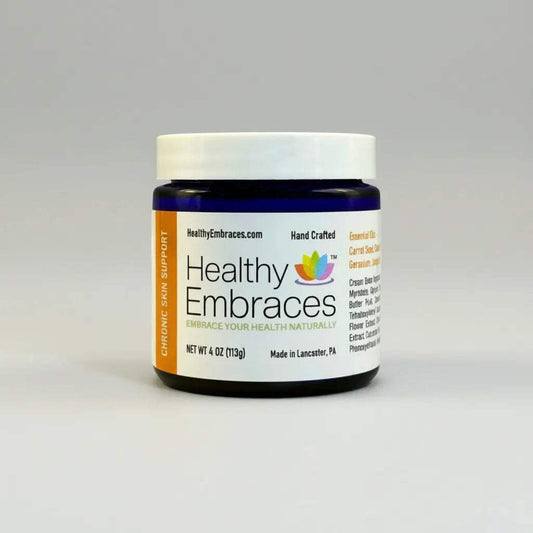 Healthy Embraces Chronic Skin Support cream in a 4oz jar, showcasing the nourishing skincare product for chronic skin issues.
