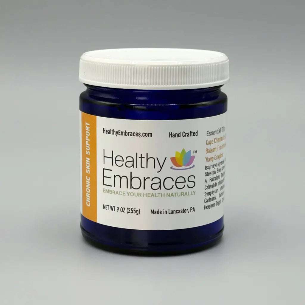 Healthy Embraces Chronic Skin Support Cream in a 4oz jar, featuring creamy texture designed for long-term skin condition relief.