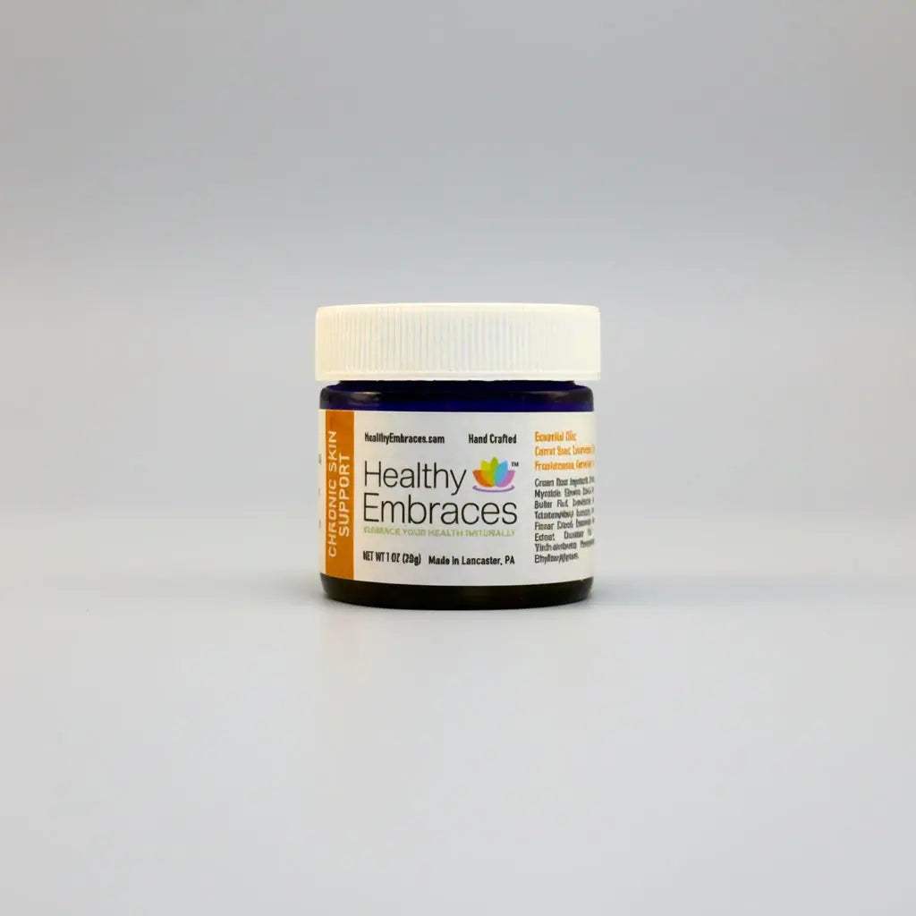 Healthy Embraces Chronic Skin Support Cream in a 4oz jar, designed for long-term skin condition relief.